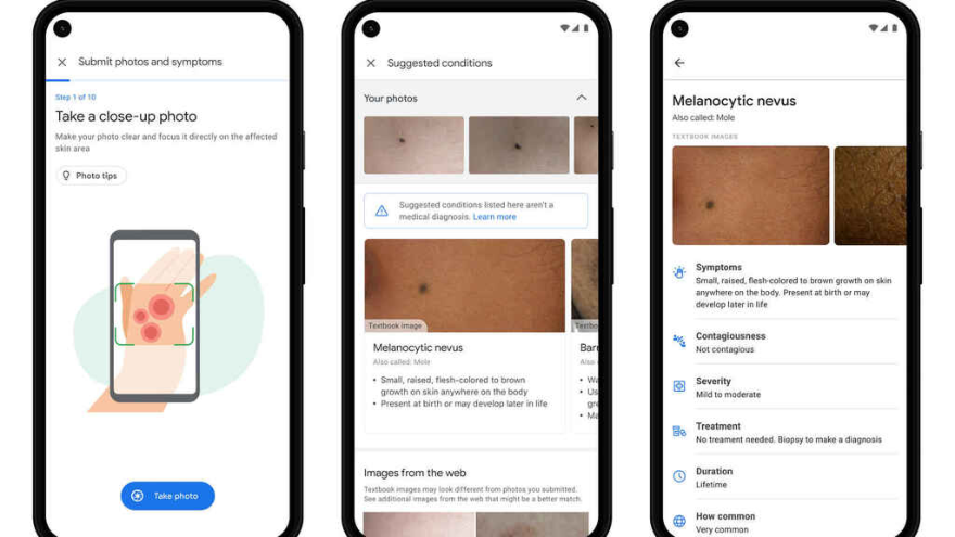 La Inteligencia Artificial de Google tendrá múltiples funciones